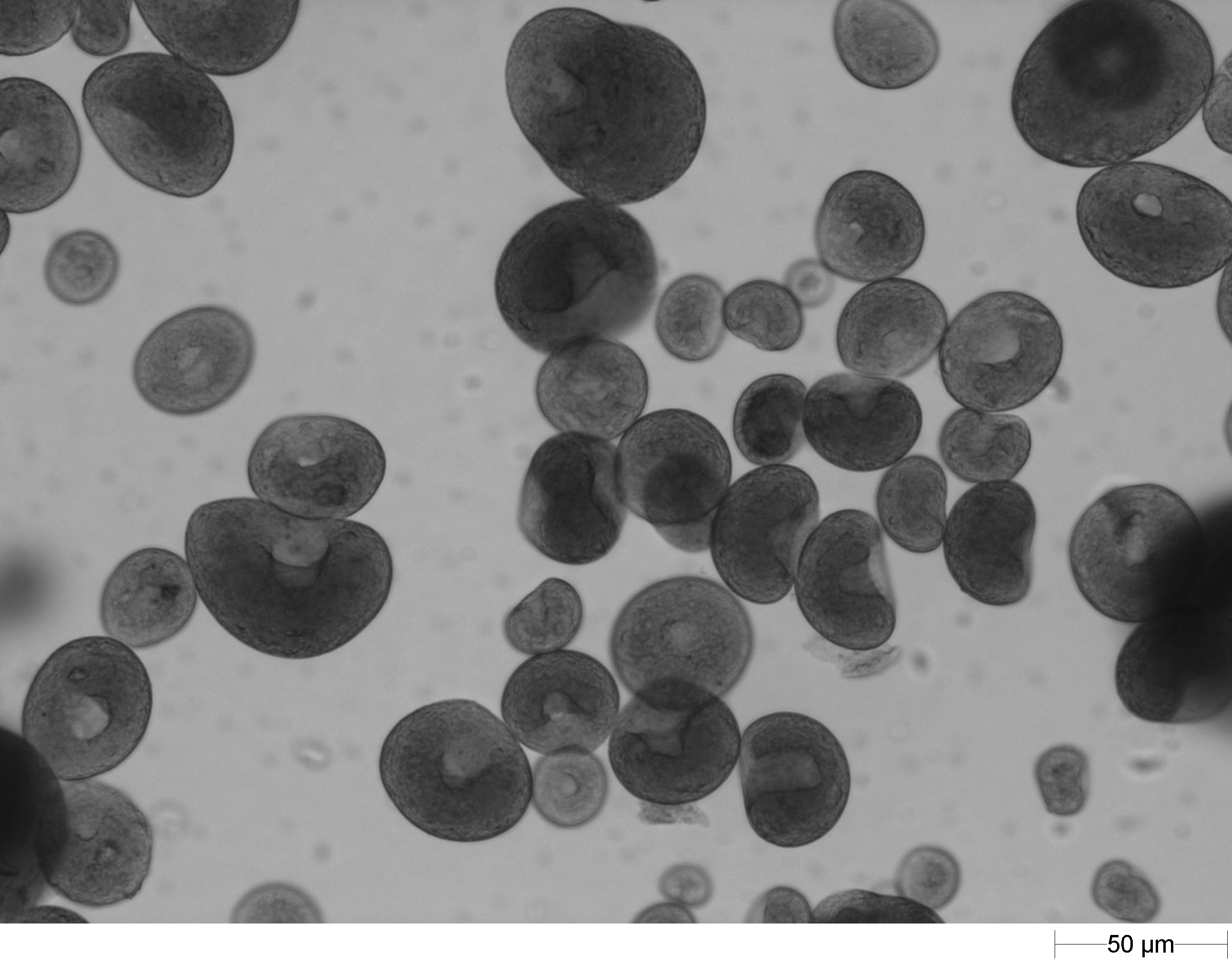 原液②(分散剤有)の回収粉_浸液透光法での顕微鏡画像